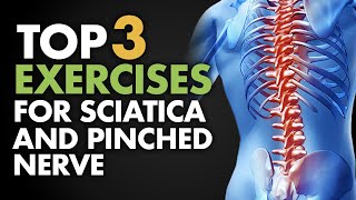 Top 3 Exercises for Sciatica and Pinched Nerve [upl. by Hekker]