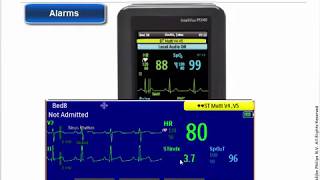 Philips IntelliVue MX40 Patient Monitor  Alarms [upl. by Drabeck672]