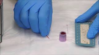 How to Measure the Hematocrit [upl. by Guttery]