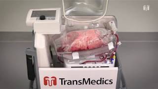 Kidney Transplantation  The Operation [upl. by Twedy]