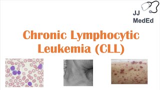 Lymphoma Action How does chemotherapy work [upl. by Llednek566]