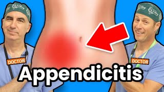 What Causes Appendicitis amp How to Treat It [upl. by Anika9]