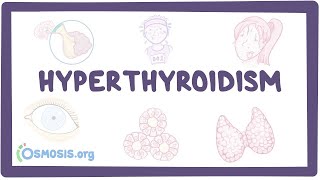 Parathyroid disease  Pathology mini tutorial [upl. by Dripps]