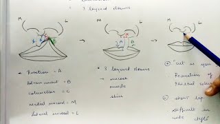 Module 6 Surgical Cleft Palate Repair Primary Secondary VPI Surgery Fistulas [upl. by Sidnal]