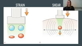 Ultrasound Elastography Explained Strain and Shear [upl. by Anitrak]