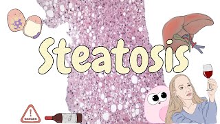 Steatosis  liver pathology [upl. by Corbett]