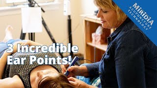 Acupressure  Acupressure Points for Shoulder Pain [upl. by Eanil]