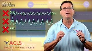 ACLS Adult Cardiac Arrest Algorithm  PEAAsystole [upl. by Suzan717]