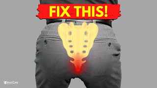 How to Fix Tailbone Pain for Good [upl. by Poul]