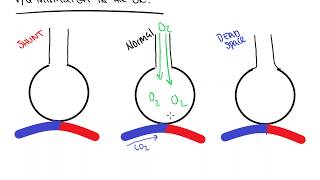 Basics of VQ Matching [upl. by Franzoni169]