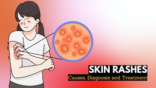 Skin Rash Causes Signs and Symptoms Diagnosis and Treatment [upl. by Deden]