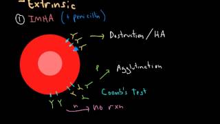 Hemolytic Anemia [upl. by Hyrup70]