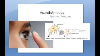 Ophthalmology 121 a AcanthAmoeba Keratitis Pseudo Dendrites eye cornea Contact lens PHMB [upl. by Anagrom]