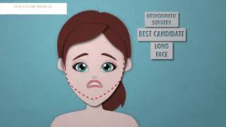 Facial Contouring VS Jaw Surgery  The Difference  Seoul Guide Medical [upl. by Shamus]