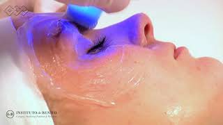 Exilis Ultra 360º  Aparatologia Facial [upl. by Sedicla661]