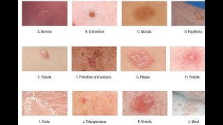 Skin Lesions with defination [upl. by Refynnej]