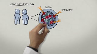 Melanocytic Dermpath Basics Melanoma [upl. by Miltie99]