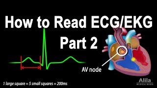 Atrial Rhythms  EKG Interpretation  LevelUpRN [upl. by Heiner566]