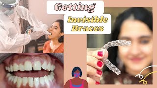 Getting Invisible braces in India  My Toothsi Aligners Review  Invisible Aligners Process amp Cost [upl. by Suivatra607]